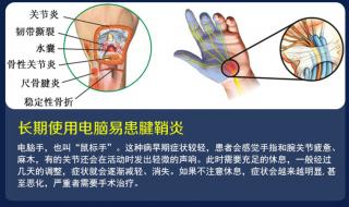 医院白色腕带代表什么 医用手腕带